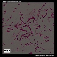 pseudomonas aeruginosa under microscope